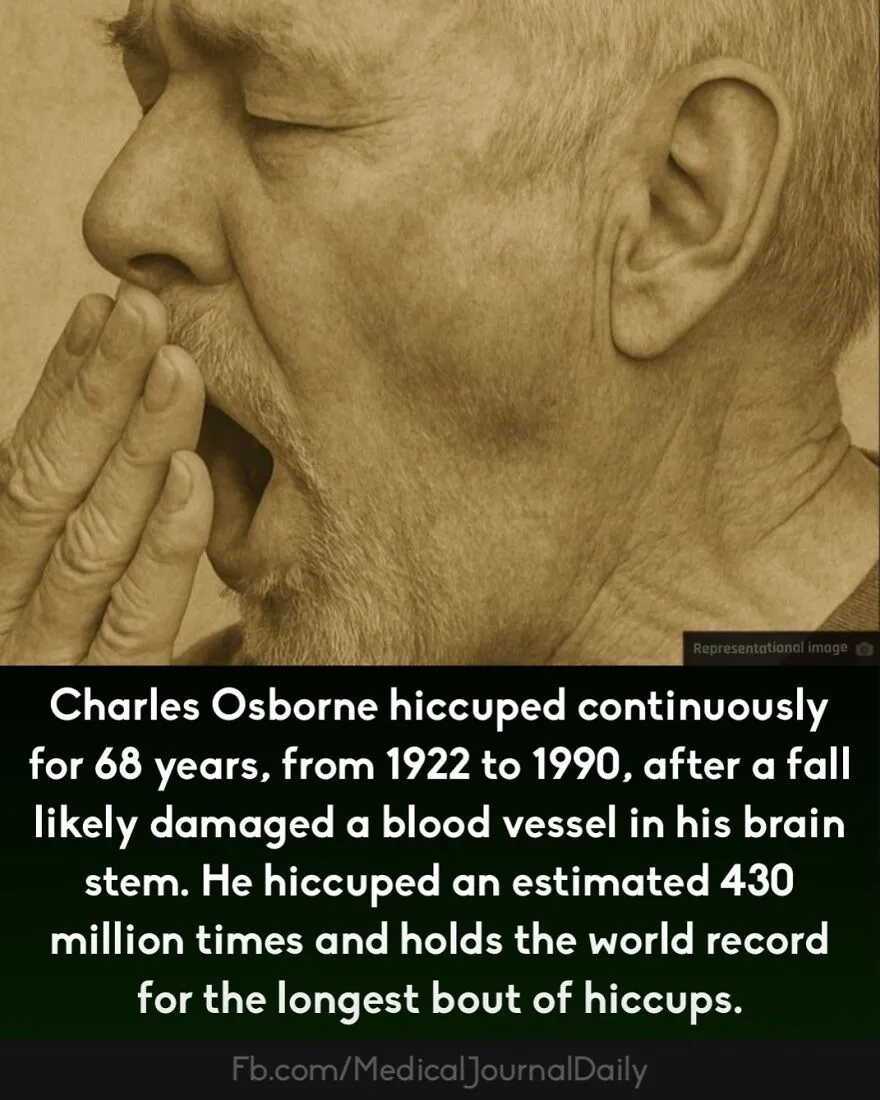 Elderly man covering mouth yawning, illustrating curious medical facts about fingers containing no muscles.