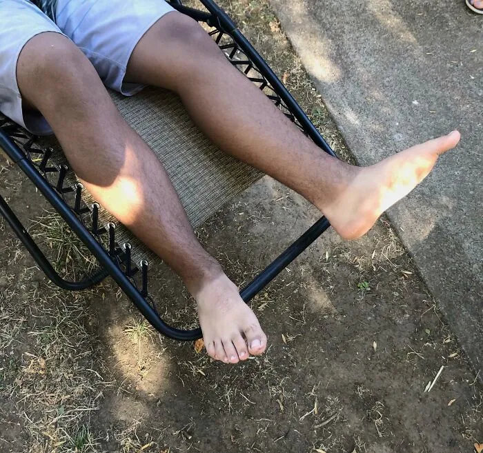 Me bronceé demasiado con los zapatos puestos. Los niños me llaman pies de chimpancé.