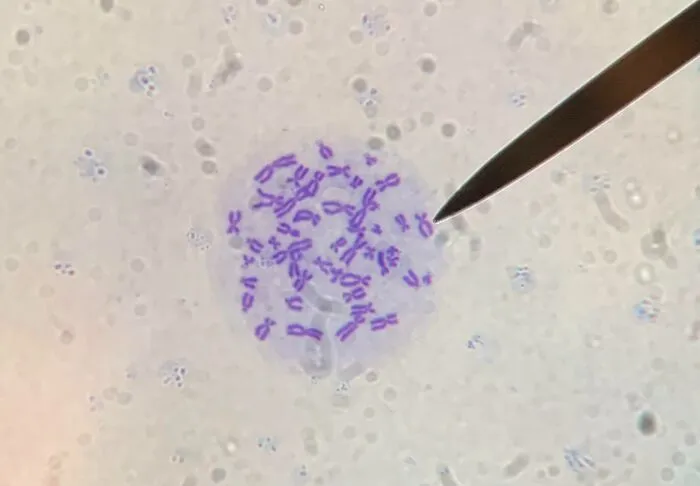 It Was Pretty Cool Seeing My Own Chromosomes. Spent A Good Amount Of Time Looking Through A Microscope During Undergrad Research. Thought I Would Share One Of The “Woah” Moments