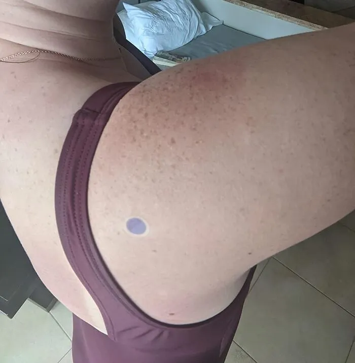 For Those Of Us Whose Internal 'Time To Reapply Sunscreen' Alarm Is Permanently On Snooze, These <a Style="Display:inline;" Href="Https://Www.amazon.com/Spotmyuv-Stickers-Sunscreen-Dermatrue-Technology/Dp/B08x6w1tzj?ie=utf8&th=1&linkcode=ll1&tag=bpowl-20&linkid=26023319590eb7d82eaee3880dea4661&language=en_us&ref_=as_li_ss_tl" Target="_blank"><span Style="Font: Inherit; Color: #d74b1f;"> UV Detection Stickers</Span> Are Basically Tiny, Colorful Lifeguards For Your Skin
