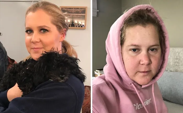 Comedian Amy Schumer shown in side-by-side makeup-less celebrity photos revealing natural look behind the scenes.