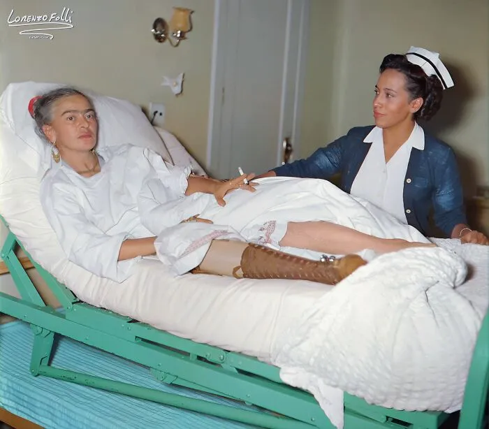 Frida Kahlo in a hospital bed with a nurse holding her hand, an interesting colorized history pic from the past.