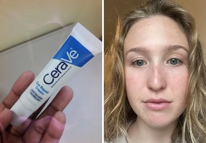 When Your Under-Eyes Are Broadcasting Your Late-Night Scrolling Habits To The Entire World, The <a Style="Display:inline;" Href="Https://Www.amazon.com/CeraVe-Repair-Cream-Circles-Puffiness/Dp/B00jjpmxdo?ie=utf8&linkcode=ll1&tag=bpsquid-20&linkid=2bd4bf81d4bf1f08c9d9d924143f3ae2&language=en_us&ref_=as_li_ss_tl" Target="_blank">    <a Style="Display:inline;" Href="Https://Www.amazon.com/CeraVe-Repair-Cream-Circles-Puffiness/Dp/B00jjpmxdo?ie=utf8&linkcode=ll1&tag=bpsquid-20&linkid=2bd4bf81d4bf1f08c9d9d924143f3ae2&language=en_us&ref_=as_li_ss_tl" Target="_blank">    <span Style="Font: Inherit; Color: #d74b1f;"> CeraVe Eye Repair Cream </Span> Can Help Them Be A Little More Discreet