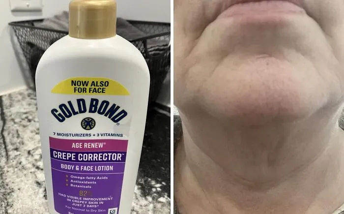When Your Skin Starts To Resemble A Well-Loved Treasure Map More Than You'd Like, <a Style="Display:inline;" Href="Https://Www.amazon.com/Gold-Bond-Corrector-Smoothing-Concentrate/Dp/B08yqx3skh?ie=utf8&th=1&linkcode=ll1&tag=bpsquid-20&linkid=44b56c47b9b68a5bd752e9e2bd9e7f64&language=en_us&ref_=as_li_ss_tl" Target="_blank">    <span Style="Font: Inherit; Color: #d74b1f;"> Age Renew Crepe Corrector Body Lotion </Span> Can Help Smooth Out The Journey