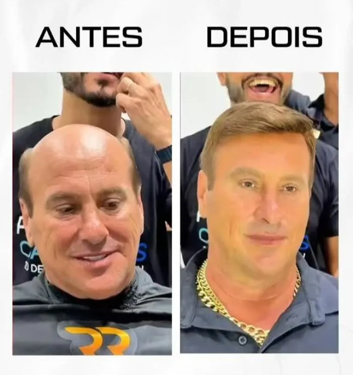Before and after images showing a Brazilian stylist helping a man with baldness regain a natural look.
