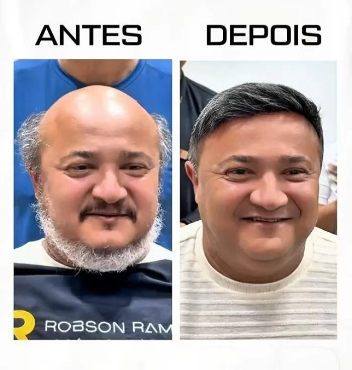 Before and after photos of a Brazilian stylist transforming men with baldness to look like themselves again.