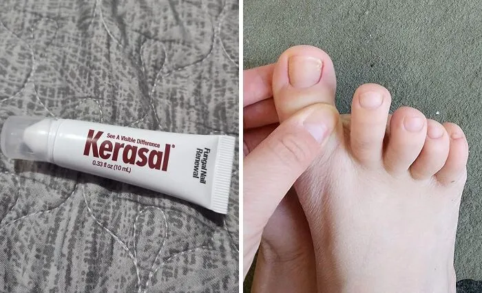 Your Nails Are About To Get A Serious Redemption Arc With A Little Help From <a Style="Display:inline;" Href="Https://Www.amazon.com/Kerasal-Fungal-Nail-Renewal-Visible/Dp/B007adol28?ie=utf8&th=1&linkcode=ll1&tag=bppelican-20&linkid=f749b9bd21be78d17f0e458bd8bbbceb&language=en_us&ref_=as_li_ss_tl" Target="_blank"> <span Style="Font: Inherit; Color: #d74b1f;"> Kerasal Nail Renewal </Span>
