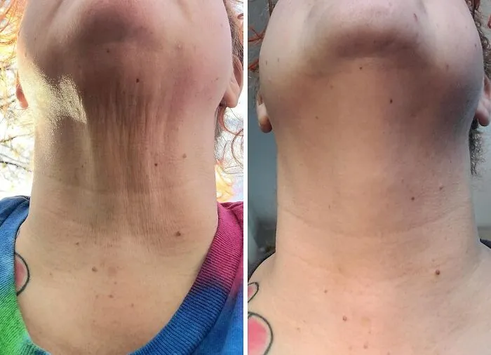 Your Neck And Chest Can Finally Get That Firming Glow-Up They've Been Scrolling Endlessly For With <a Style="Display:inline;" Href="Https://Www.amazon.com/Gold-Bond-Moisturizing-Salicylic-Hydration/Dp/B01b5d3voc?ie=utf8&th=1&linkcode=ll1&tag=bppelican-20&linkid=e134e52a2d89707a91a6b2b17134938b&language=en_us&ref_=as_li_ss_tl" Target="_blank"> <span Style="Font: Inherit; Color: #d74b1f;"> Gold Bond Age Renew Neck & Chest Firming Cream </Span>