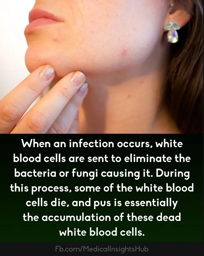 Close-up of a person touching a pimple on their chin, illustrating curious medical facts about fingers containing no muscles.