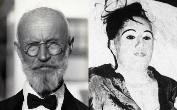 Carl Tänzler era un radiólogo que se obsesionó con Elena Milagro, una paciente con tuberculosis, incluso después de su muerte. Sostuvo su cuerpo con seda y yeso. Su cuerpo fue mantenido unido con numerosos equipos, sus ojos fueron reemplazados por vidrio y durmió con su cadáver durante siete años.
