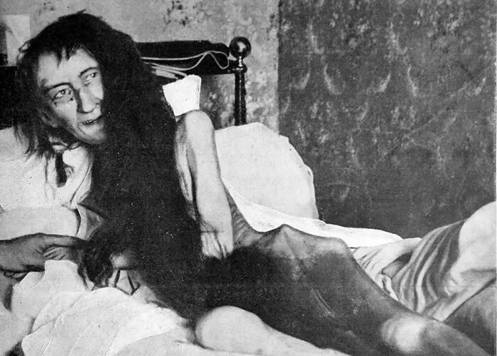 Blanche Monnier Was Secretly Kept Locked In A Small Room By Her Aristocratic Mother And Brother For 25 Years. Monnier Had Not Seen Any Sunlight For Her Entire Captivity