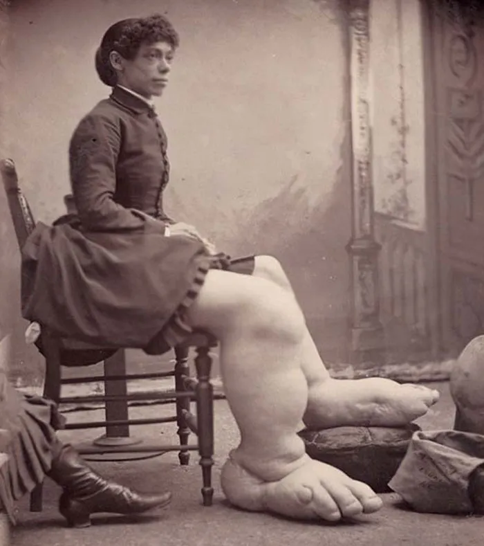 La señora Fannie Mills, también conocida como "La chica Pie Grande de Ohio"