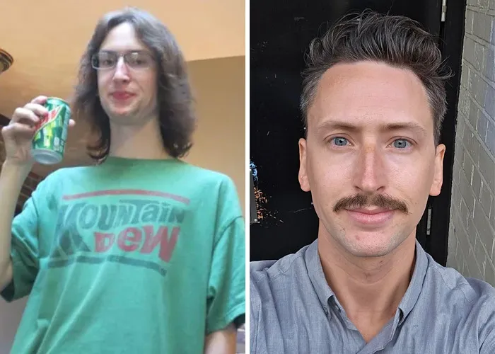 22 To 32 – Late Bloomer To Say The Least, But I'm Finally Happy With My Looks