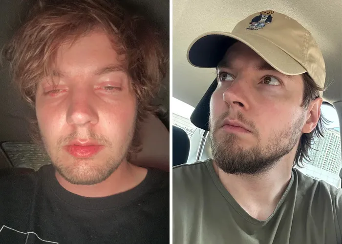 2 Years Sober From O***ids (Healthier And Willing To Live Finally) 29m