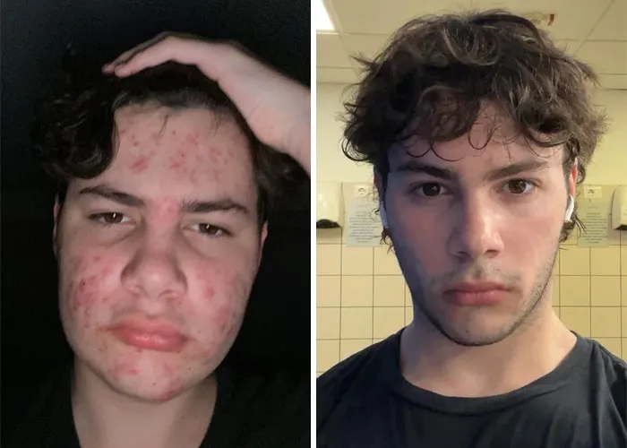 Me (16) -> Me (18) Current 