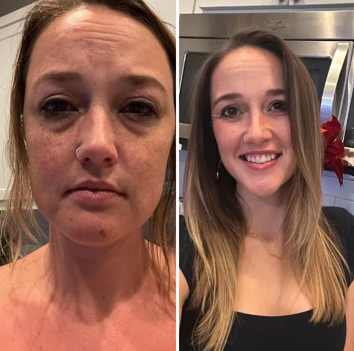 One Year Alcohol Free