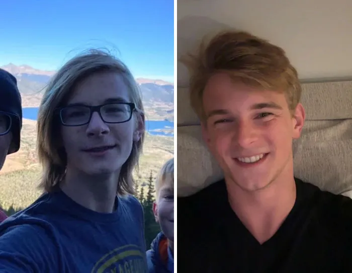 15 To 19 Finally Beat My Anorexia And Started Taking Care Of Myself