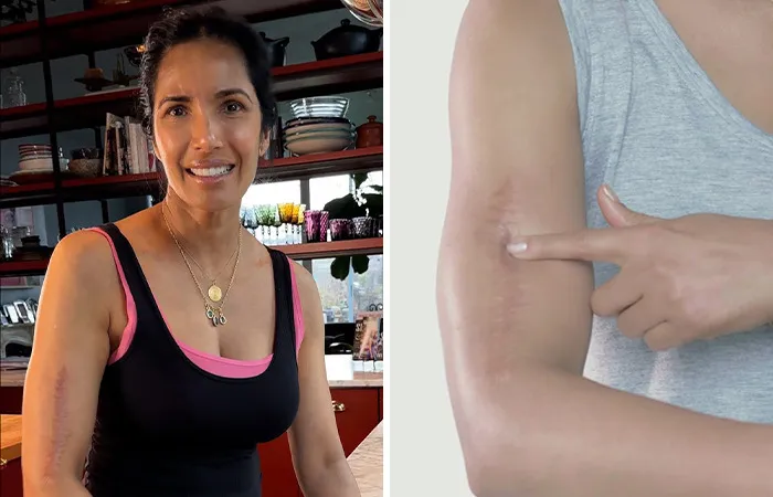 Padma Lakshmi