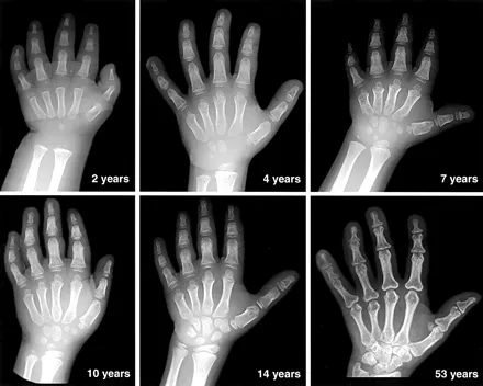 X-ray images showing the development of the human hand bones at different ages, highlighting bizarre and fascinating anatomy.
