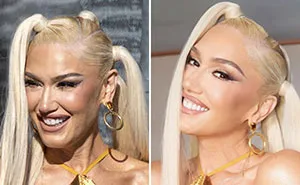 Celebrity Retouching: 12 Photoshopped Images With Noticeable Differences