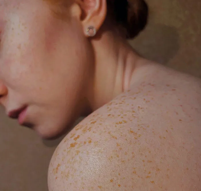 Nobody's Perfect But These 48 Human Body Flaws Are Just Stupid