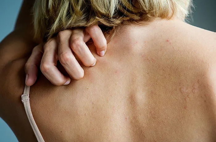 Person scratching skin on their back revealing visible skin flaws and imperfections of the human body
