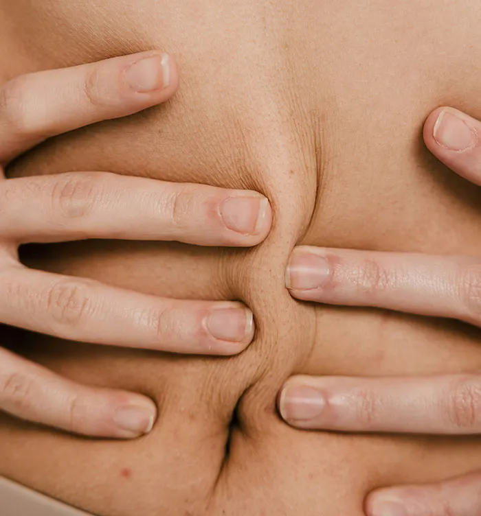 Close-up of hands pinching loose skin highlighting one of the biggest flaws of the human body related to skin elasticity.