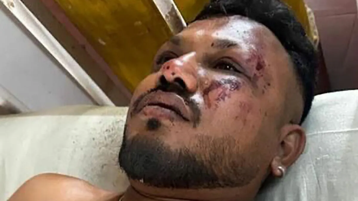 “Coincidence?”: Thai Actor Who Survived Plane Crash Discovers Eerie Link To Air India’s Only Survivor