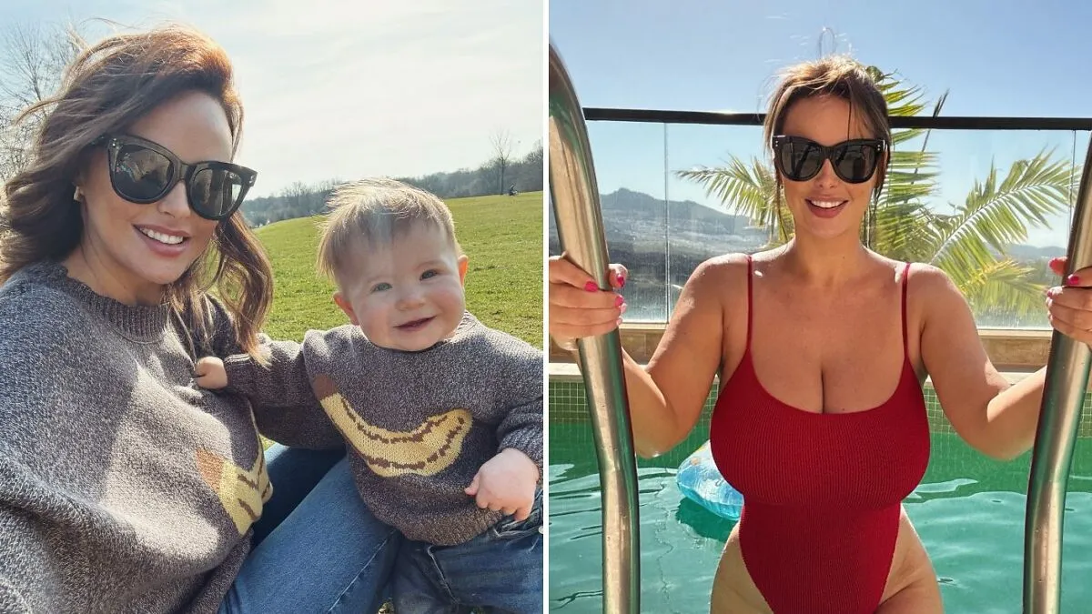 Model With F-Cup Chest Undergoes Breast Reduction Surgery After Walking Became “Unbearable”