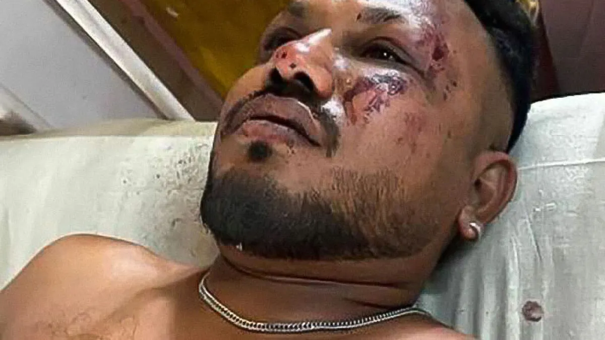 "Heartless": Actress Sparks Outrage After Accusing Air India Crash Miracle Survivor Of Lying