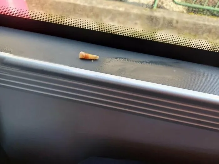 Someone Took Their Tooth Out On The Bus And Left It There