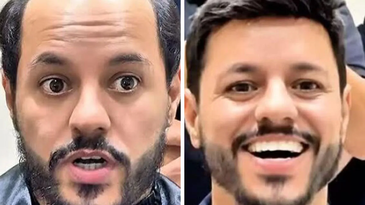 These 40 Men Got Non Surgical Hair Makeovers, And The Results Are Shockingly Natural Looking