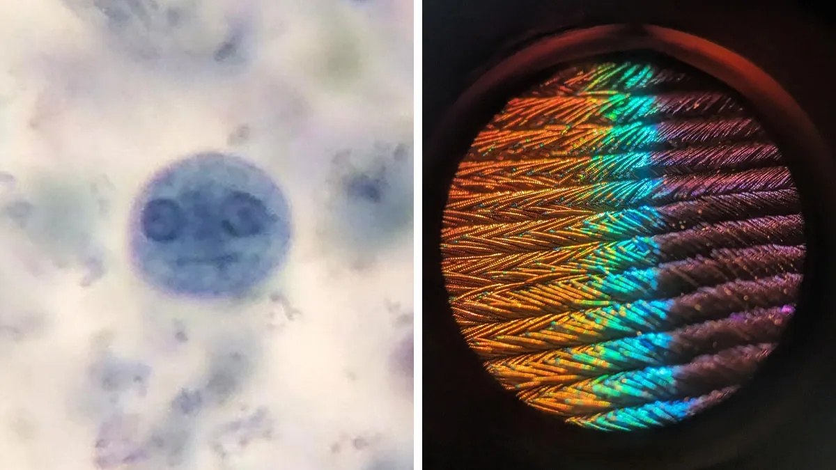 People Who Have A Microscope Share The Most Interesting Things They Observed Up Close (New Pics)