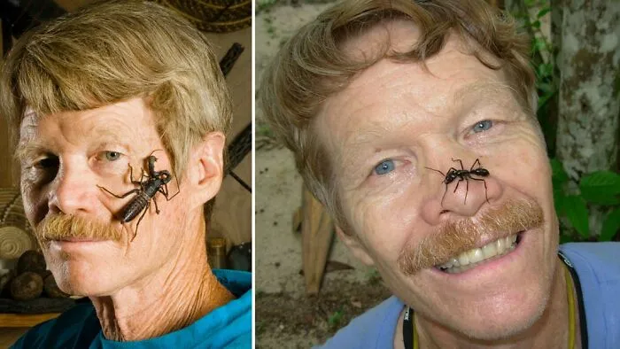 El Índice de Dolor Schmidt fue creado por un hombre que se sometió intencionalmente a las picaduras de 78 especies diferentes de himenópteros (abejas, avispas, hormigas, etc.) para cuantificar la intensidad del dolor experimentado