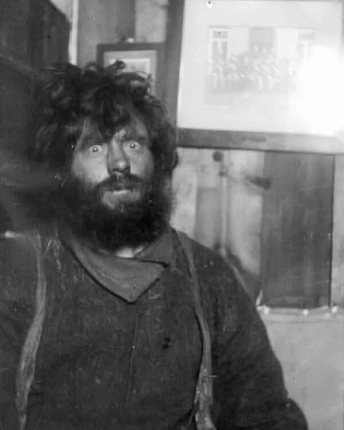 Hombre con aspecto desaliñado y barba espesa, mostrando un lado distinto de la historia en fotografía antigua.