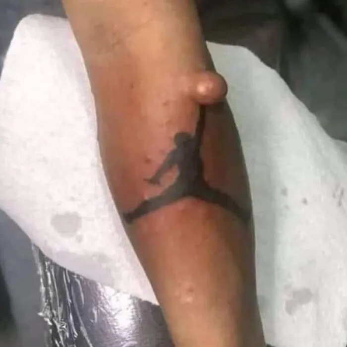 Arm tattoo with a silhouette design and a large raised bump, showcasing bizarre choices people made while getting tattoos.