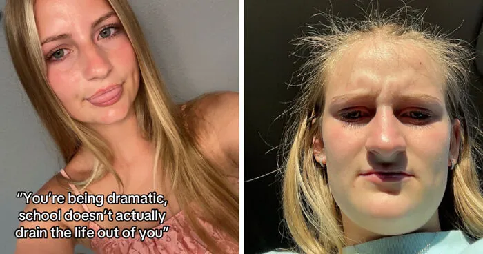 Folks Share 25 Pics Of Before And After “Life Happened” To Them