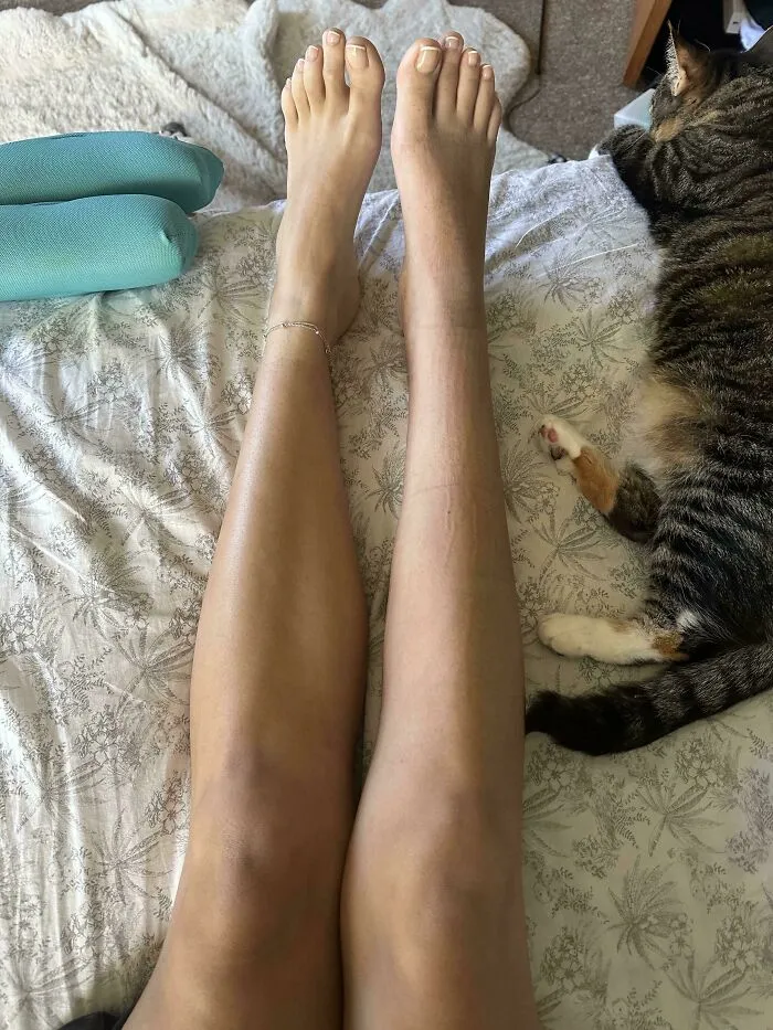 Person's legs showing a distinct tan line difference, lying on patterned bed sheets next to a resting cat, mildly interesting sight.