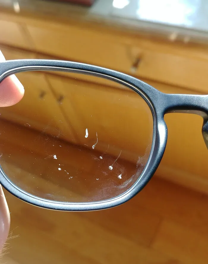 Got New Glasses Three Weeks Ago. Dents Are From A High-Speed Bottle Cap From My Co-Worker's Soda
