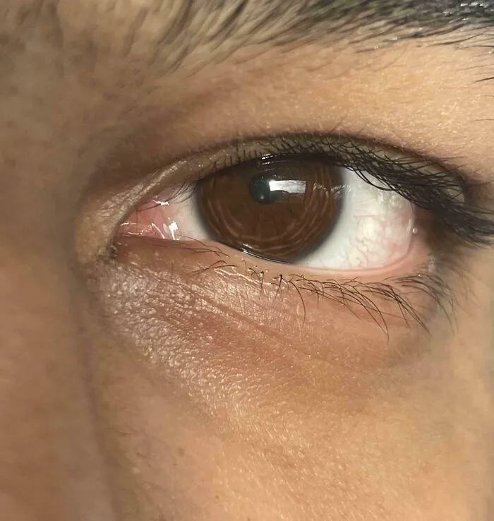 Close-up of a brown eye showing natural skin texture and eyelashes, highlighting a mildly interesting detail.