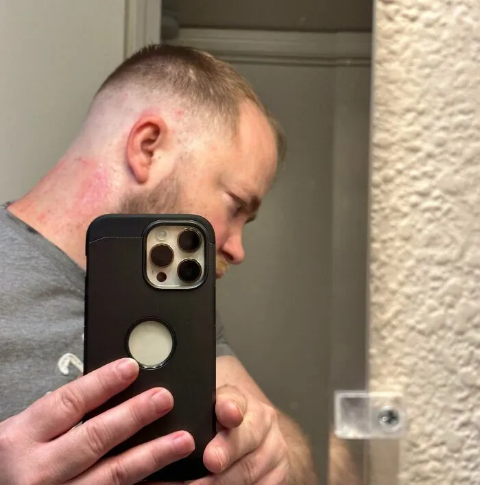 Man taking a mirror selfie showing a fresh haircut and red skin irritation after a salon glow-up experience.