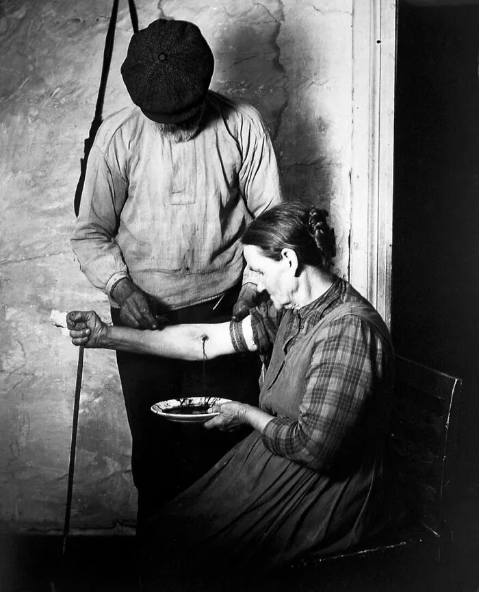 Black and white photo of an old medical device being used on a woman’s arm in a historical medical setting.