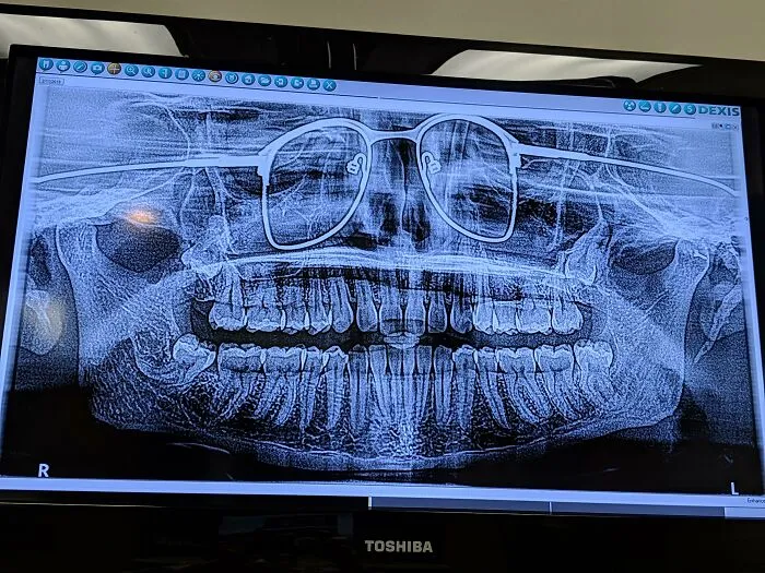 El otro día me hicieron una radiografía panorámica. El dentista olvidó decirme que me quitara las gafas