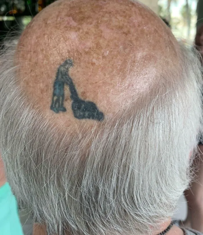 La forma en que este hombre se enfrenta a la pérdida de cabello es de primer nivel