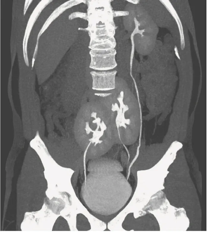 Radiografía médica mostrando órganos internos y estructura ósea como ejemplo de fotos médicas que demuestran que el cuerpo es a veces aterrador.