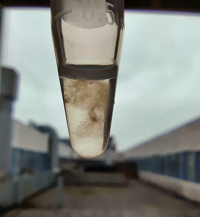 Imagen de muestra médica en tubo de ensayo que revela aspecto inquietante del cuerpo humano en un entorno clínico.
