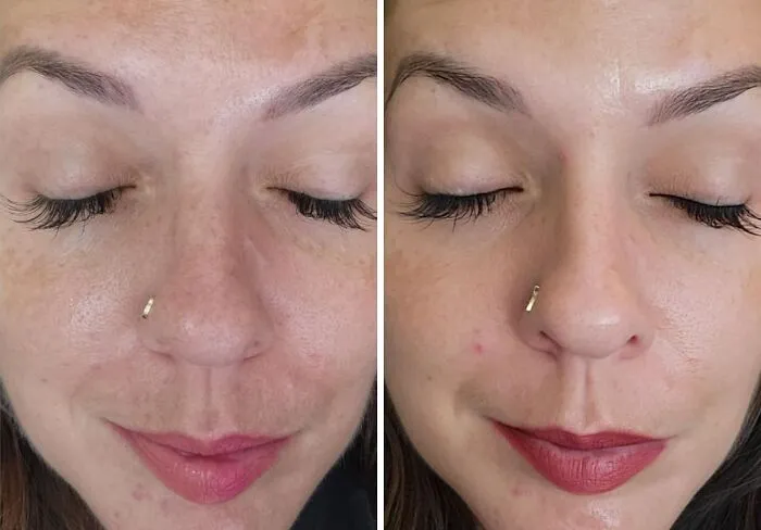 Your Face Can Get That "Lit From Within" Glow Even If You're Actually Powered By Three Cups Of Coffee And Sheer Willpower With <a Style="Display:inline;" Href="Https://Www.amazon.com/Vitamin-Serum-Face-Ageing-Brightening/Dp/B07p5tmhd9?ie=utf8&linkcode=ll1&tag=bprat-20&linkid=1905424ba8a3185e53b38f66501d8393&language=en_us&ref_=as_li_ss_tl" Target="_blank">  <span Style="Font: Inherit; Color: #d74b1f;"> Eclat Skincare Vitamin C Face Serum </Span>
