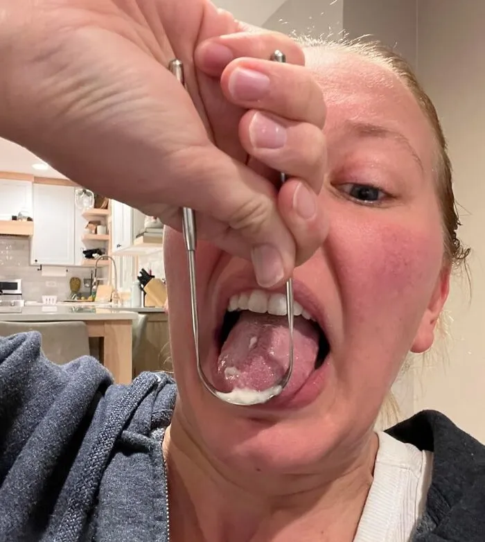 The Fuzzy Sweater Your Tongue Insists On Wearing Every Morning Can Be Gently Removed With A<a Style="Display:inline;" Href="Https://Www.amazon.com/Tongue-Scraper-Adults-Cleaner-Metal-Tounge-Scrapper/Dp/B08ntw58lx?ie=utf8&th=1&linkcode=ll1&tag=bprat-20&linkid=19e399612971369eb5e05ef34fefc2af&language=en_us&ref_=as_li_ss_tl" Target="_blank">   <span Style="Font: Inherit; Color: #d74b1f;"> Tongue Scraper </Span>