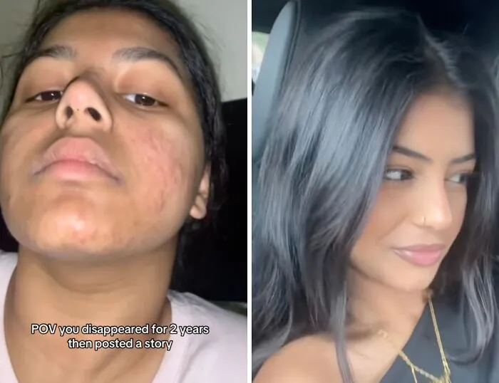 50 Glow-Ups People Are Proud Of And Wanted To Share