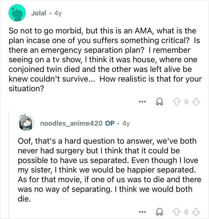 Conjoined Twins Answer 24 People’s Most Interesting And Burning Questions